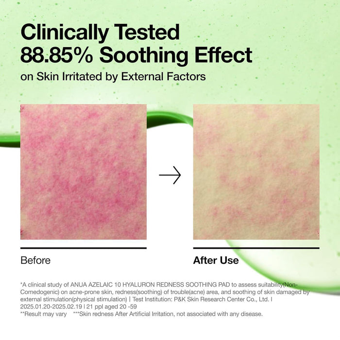 ANUA Azelaic Acid 10 Hyaluron Redness Soothing Pad 90 pads