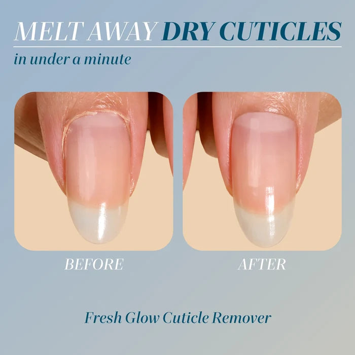 Two close-up images of a fingernail show dry cuticles in the "before" photo and smooth, healthy cuticles in the "after," illustrating the benefits of LONDONTOWN's Cuticle Refresh for effective cuticle care.