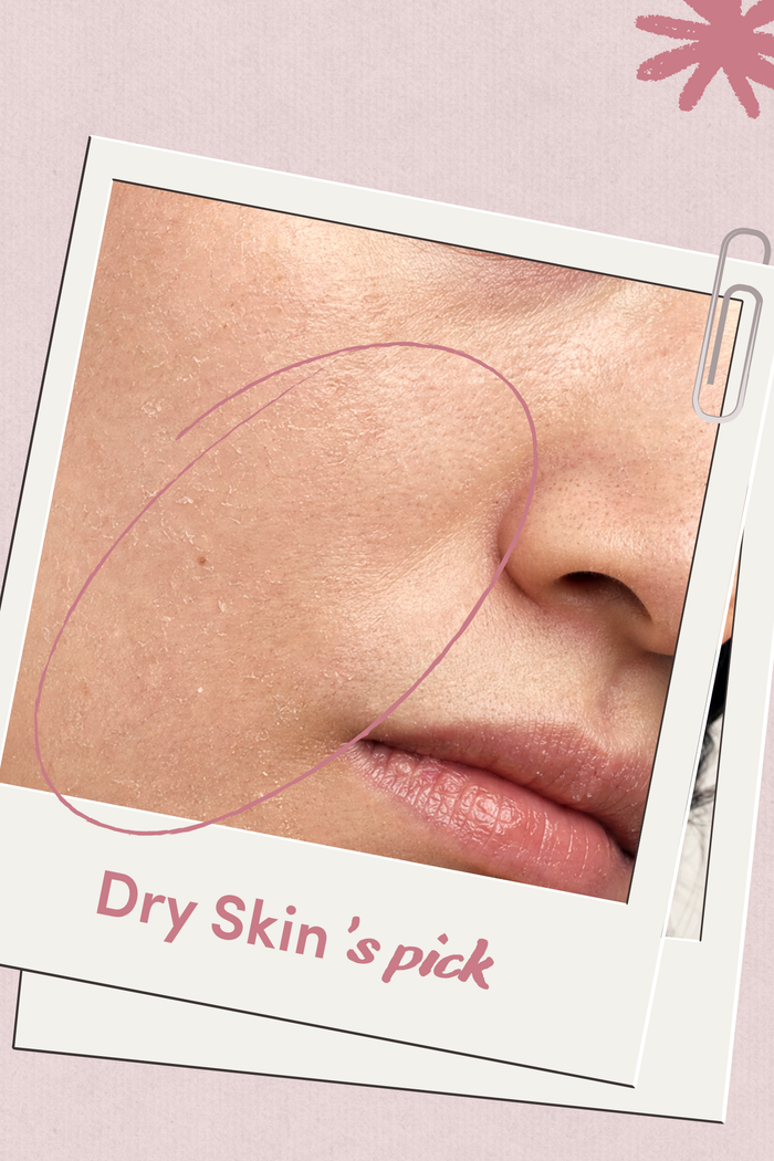 DRY SKIN INSTANT AQUA-BOMB HYDRATION SET