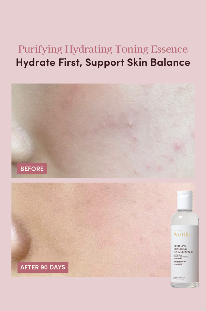 DRY SKIN INSTANT AQUA-BOMB HYDRATION SET