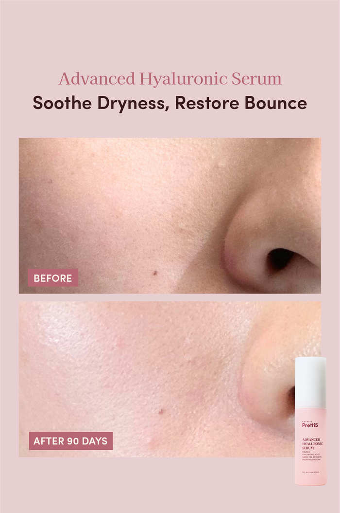 DRY SKIN INSTANT AQUA-BOMB HYDRATION SET