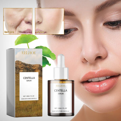 EELHOE Centella Serum, Intensive Moisturizing Improve Dry Skin Smooth And Tender Skin Brighten Hydrating Essence