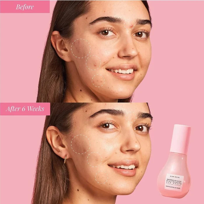 GLOW RECIPE Watermelon Glow Niacinamide Dew Drops سيروم ترطيب البشرة واشراقتها من گلو ريسبي