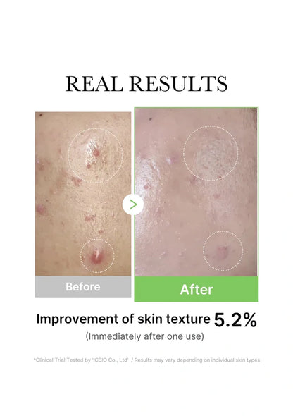 Before and after comparison of skin texture improvement with text indicating 5.2% improvement.