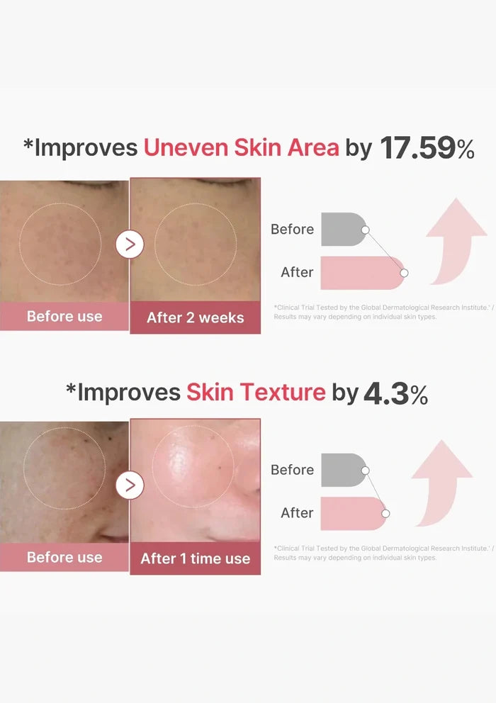 Before and after skin improvement results with percentages shown on a white background