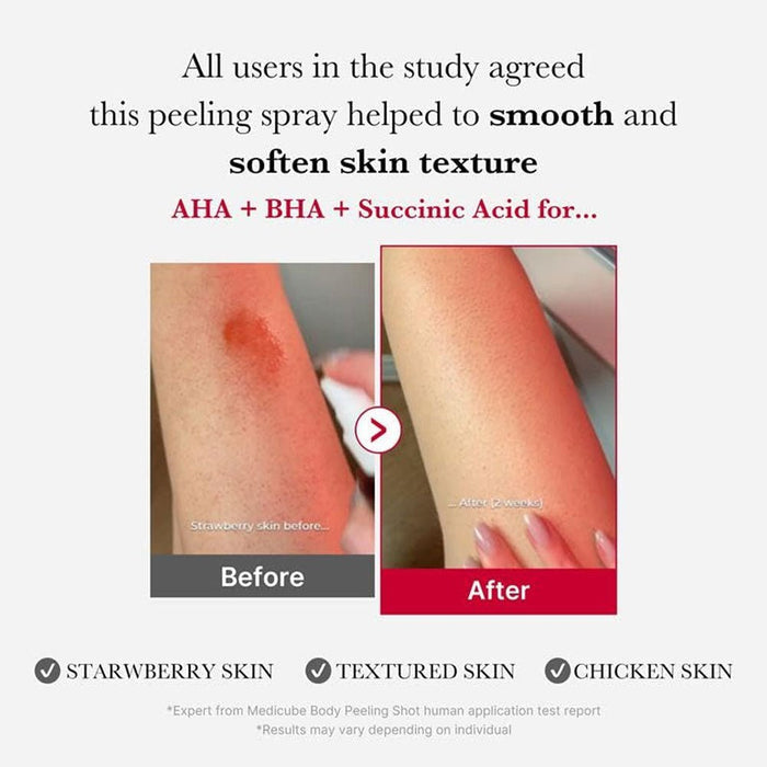 Medicube Red Acne Body Peeling Shot 110g حقنة تقشير الجسم من ميديكيوب ريد لعلاج حب الشباب - Princess Cosmetics Qatar