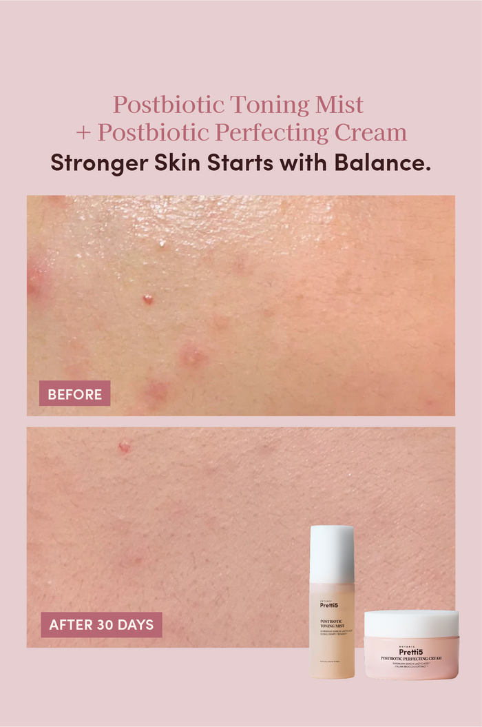 OILY ACNE-PRONE SKIN MICROBIOME BALANCING SET