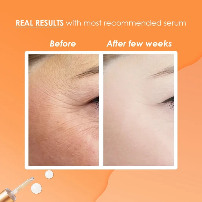 Sesderma C-Vit Liposomal Serum 30ml