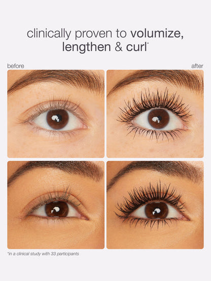 Before and after comparison of eyelashes with text indicating clinical provenance.