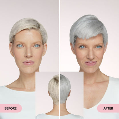 Before & After